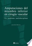 Amputaciones del miembro inferior en cirugía vascular. Un problema multidisciplinar