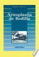 Artroplastia de rodilla