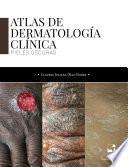 Atlas de dermatología clínica
