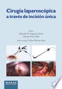 Cirugía laparoscópica a través de incisión única