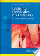 Lesiones Cervicales no Cariosas