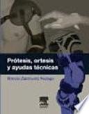 Prótesis, órtesis y ayudas técnicas