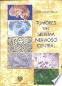 Tumores del sistema nervioso central